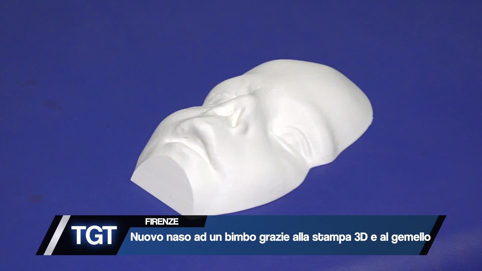 Firenze - Bimbo senza nasino, ci pensa il Meyer Thumbnail